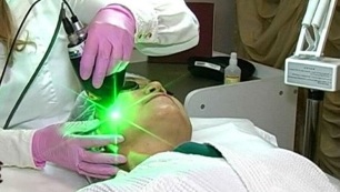 wady i zalety laserowego odmładzania skóry twarzy