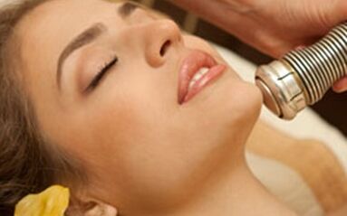 Plusy i minusy frakcyjnego laserowego odmładzania skóry